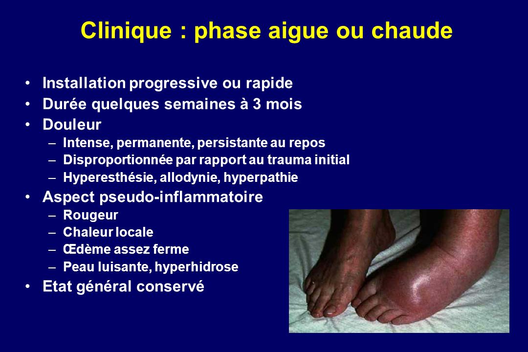 ALGODYSTROPHIE DU PIED ppt video online t l charger